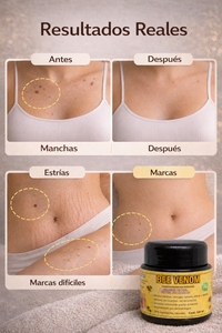 BEE VENOM CICATRICES Y MANCHAS